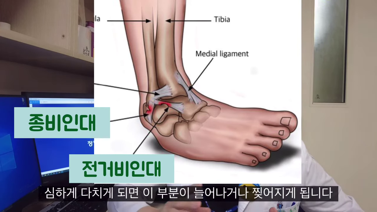 발목통증 발목 바깥쪽 통증 전거비인대 종비인대 발목 불안정 접질림 발목 삠